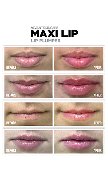 Maxilip Lip Plumper